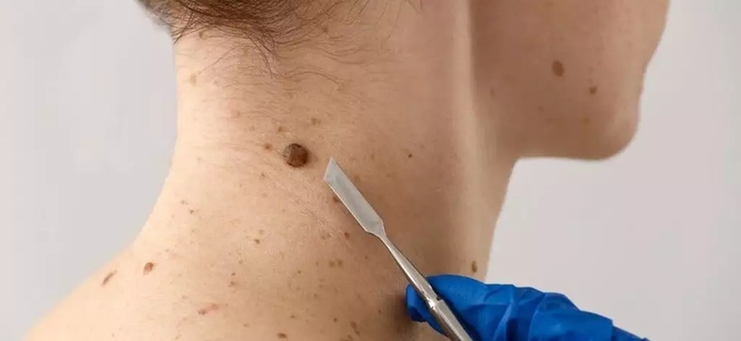 Mutirão com médicos especialistas atende quase 100 pacientes em Ponta Porã